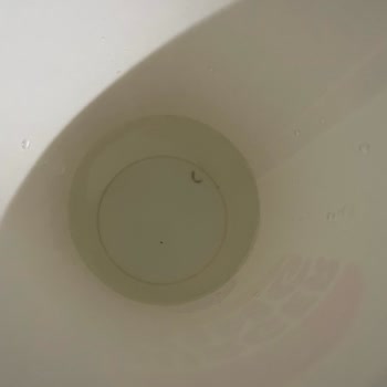 Siparişimde Hijyen Sorunu Ve Yabancı Madde Şoku Yaşadım