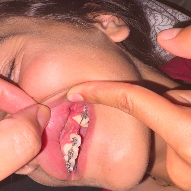 Ameliyat Sonrası Hatalı Müdahale Ve Yetersiz Bilgilendirme Nedeniyle Yaşanan Mağduriyet