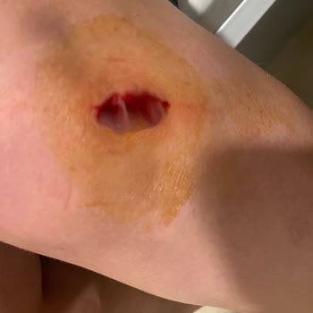 Sephora Mağazasında Çekmeceden Kaynaklı Ciddi Yaralanma Ve İlgisiz Yönetici