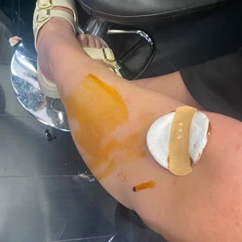 Sephora Mağazasında Çekmeceden Kaynaklı Ciddi Yaralanma Ve İlgisiz Yönetici