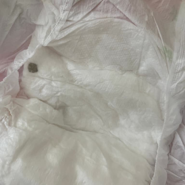 Bebek Bezinde Yabancı Madde Ve Sağlık Endişesi