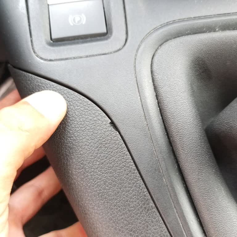 Serviste Aracımın Göğüs Kısmı Zarar Gördü, Hiçbir Geri Dönüş Alamadım