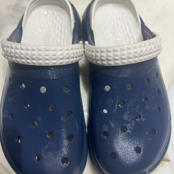 Ceyo Terlik Ayağımı Yaraladı, İade Ve Açıklama Bekliyorum