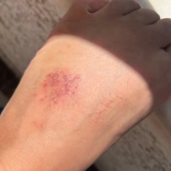 Ceyo Terlik Ayağımı Yaraladı, İade Ve Açıklama Bekliyorum