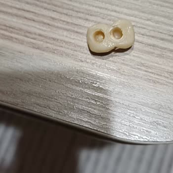 Eksik Ve Hatalı Tedaviyle Sağlığım Bozuldu, Paramı Geri İstiyorum!