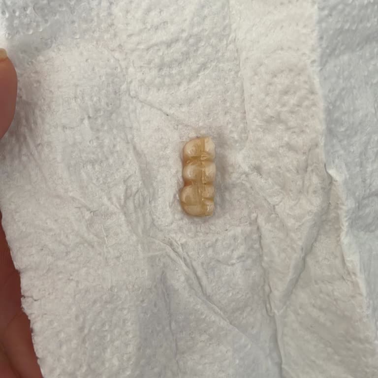 Eksik Ve Hatalı Tedaviyle Sağlığım Bozuldu, Paramı Geri İstiyorum!