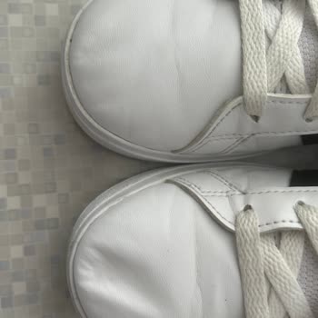 Adidas Ayakkabıda Kısa Sürede Deri Kırılması Ve Deformasyon