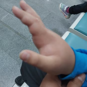 Böcek Isırığı Ve Hijyen Sorunları Nedeniyle Mağduriyet Yaşadık