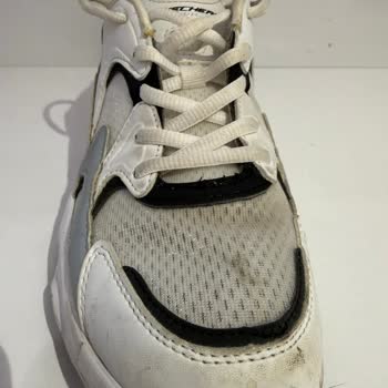 Skechers Ayakkabım Yırtıldı, Garanti Talebim Reddedildi