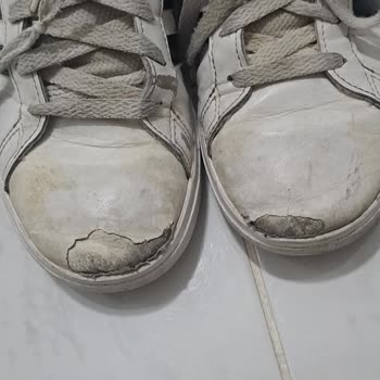 Adidas Ayakkabı Kısa Sürede Yırtıldı, Değişim Talebim Reddedildi