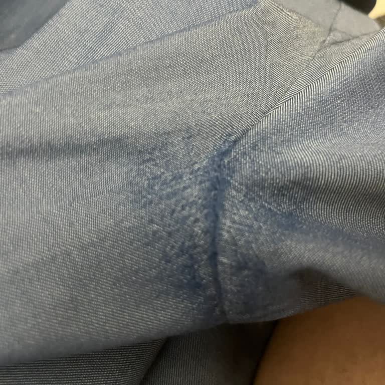 Bir Kez Giyilen Takım Elbisede Deformasyon Ve İade Reddi Mağduriyeti