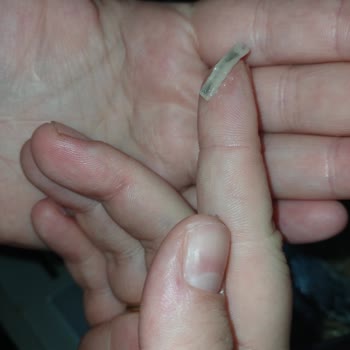 Gıda Ürününde Yabancı Madde ve İletişim Sorunu Hakkında Endişe