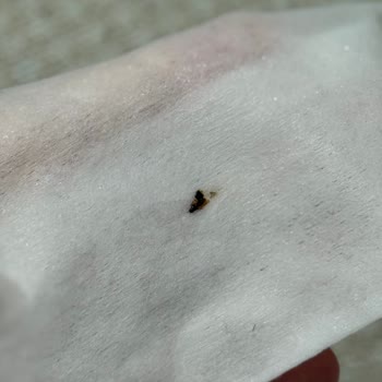 Islak Mendil Paketinden Ölü Sinek Çıkması Nedeniyle Endişe Ve Açıklama Talebi