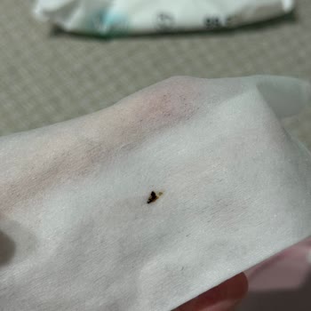 Islak Mendil Paketinden Ölü Sinek Çıkması Nedeniyle Endişe Ve Açıklama Talebi