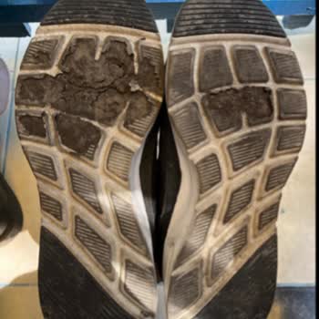 Kısa Sürede Deforme Olan Skechers Ayakkabı İçin İade Veya Değişim Talebi