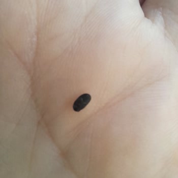 Aldığım Mercimekten İki Kez Böcek Çıktı, Mağduriyetim Giderilsin