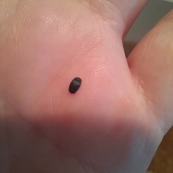 Aldığım Mercimekten İki Kez Böcek Çıktı, Mağduriyetim Giderilsin