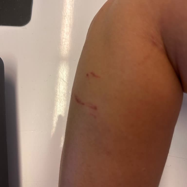 Parkta Başıboş Hayvanlar Nedeniyle Güvenlik Endişeleri