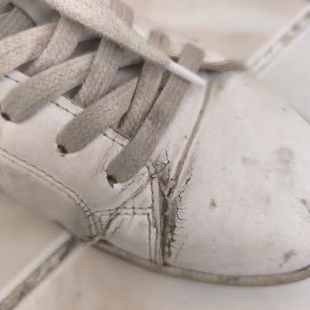 İki Ayda Yıpranan Sneaker Ve Sonuçsuz İnceleme Süreci Mağduriyetim