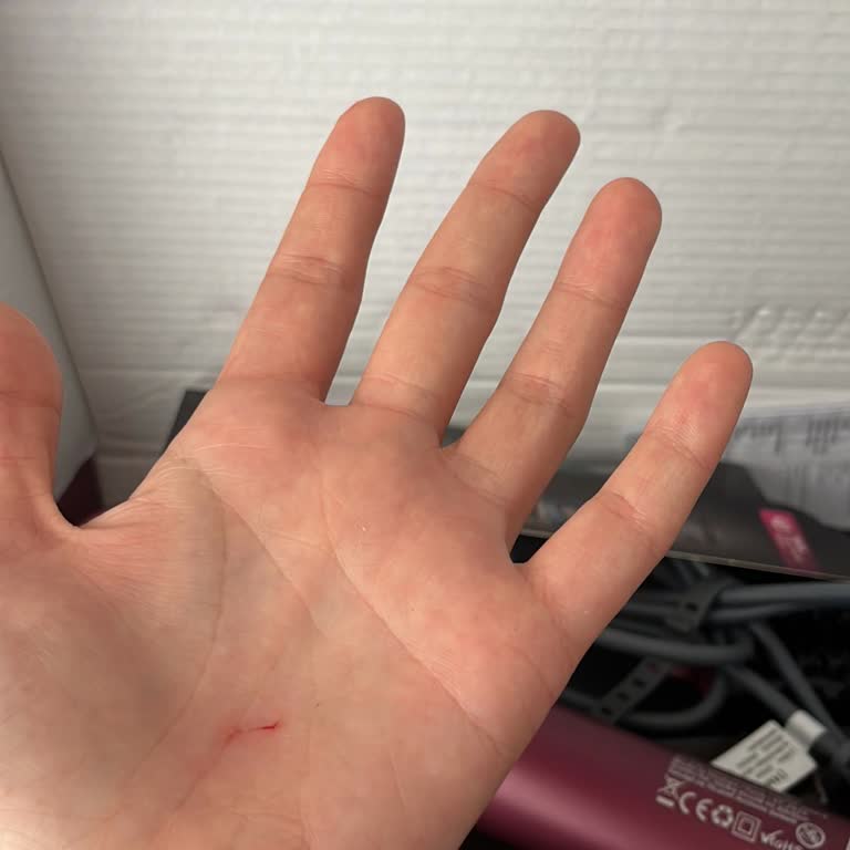 Saç Kurutma Makinesi Güvenlik Sorunu ve Garanti Süreci Hakkında Şikayet