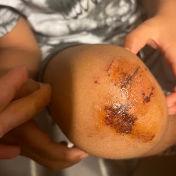 Çocuğumun Scooterı 2 Gün İçinde Kırıldı, Güvenlik Riski Oluştu