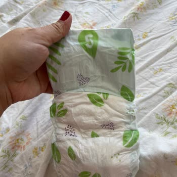 Canbebe Bebek Bezinde Terleme Ve Ciddi Yara Problemi Yaşadık