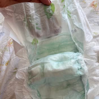 Canbebe Bebek Bezinde Terleme Ve Ciddi Yara Problemi Yaşadık