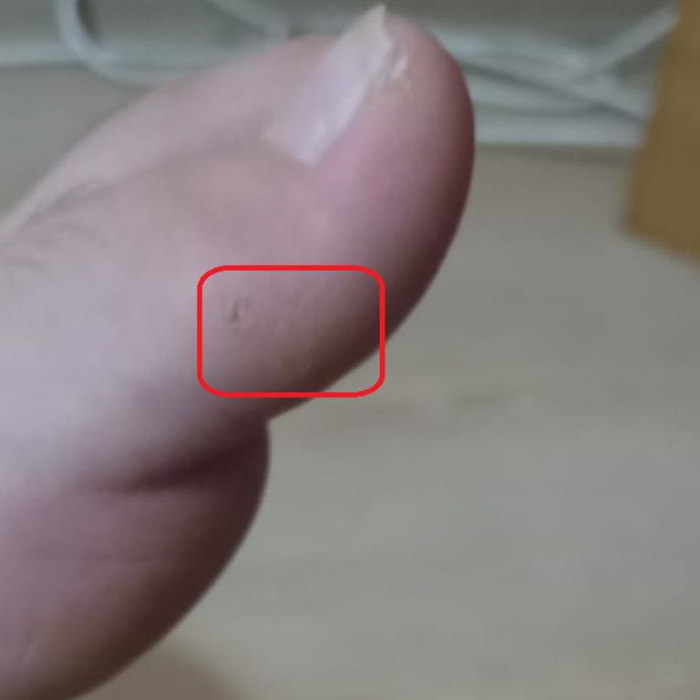 Hapshoe.com Çocuk Ayakkabısında Oluşan Sorun Ve İade Talebinin Reddedilmesi