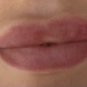 Dudak Renklendirme İşlemi Sonrası Renk Tutmadı Ve Ücret İadesi Talebi