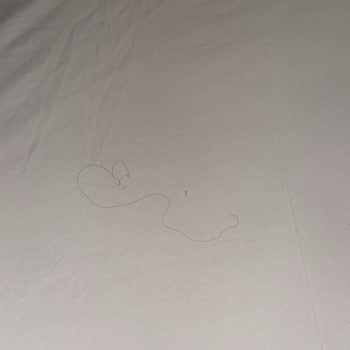 Hijyen Sorunları Nedeniyle Konaklama Ücretimin İadesini İstiyorum