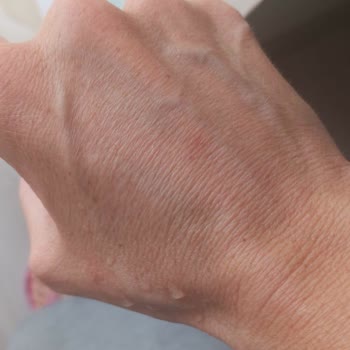 Doğal Yağ Çözücü Ciltte Tahrişe Sebep Oldu, Uyarı Eksikliği Var!