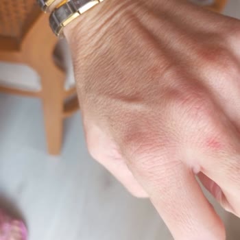 Doğal Yağ Çözücü Ciltte Tahrişe Sebep Oldu, Uyarı Eksikliği Var!