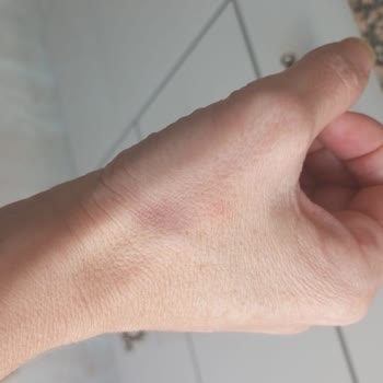 Doğal Yağ Çözücü Ciltte Tahrişe Sebep Oldu, Uyarı Eksikliği Var!