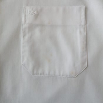 Tefal Ütü Buharı Gömleklerde Küf Lekesi Bırakıyor