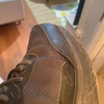 Skechers Ayakkabıda 6 Ayda Açılma Ve Garanti Sürecinde Çözüm Sunulmaması