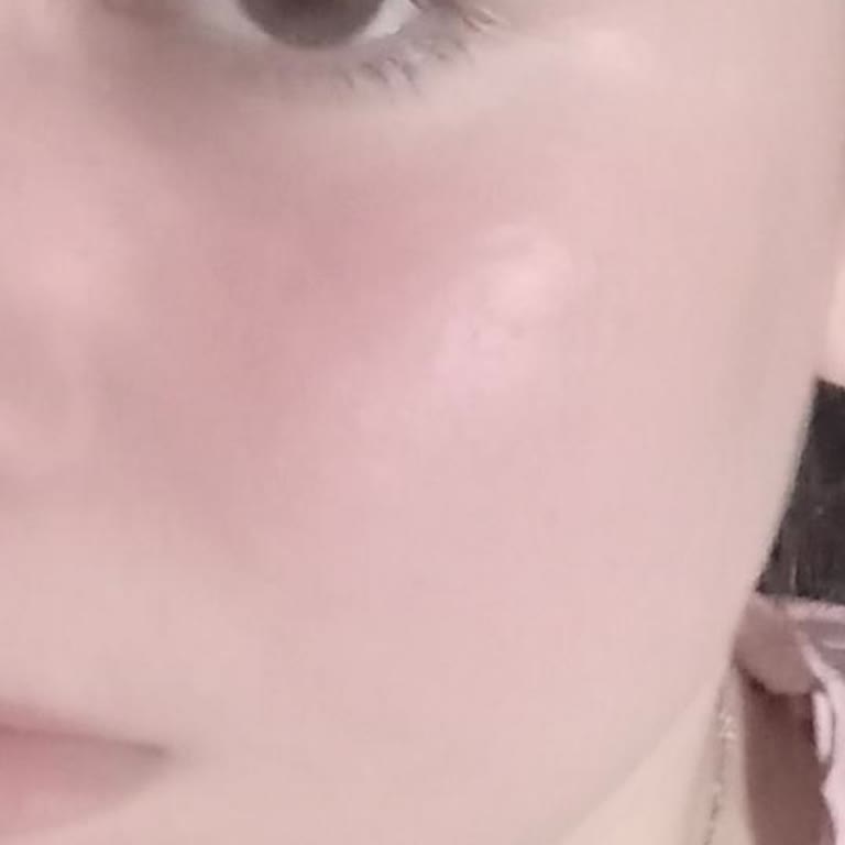 Mi experiencia con ardor y enrojecimiento usando Neutrogena facial