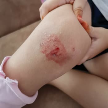 Ayvacık Belediyesi'nin İhmali: Sokak Temizliği Ve Güvenliği Sağlanmıyor