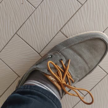 Satın Aldığım Ayakkabıda Kısa Sürede Deformasyon Ve Çözümde Sürekli Yönlendirme Sorunu