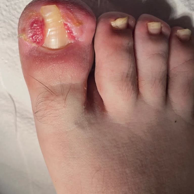 Başarısız Ameliyat, İlgisiz Doktor: Kızımın Mağduriyeti