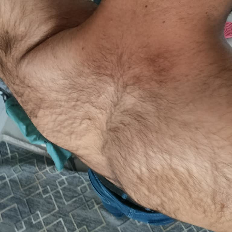 Yanıltıcı Hizmet Ve Sonuçsuz Lazer Epilasyon Deneyimi