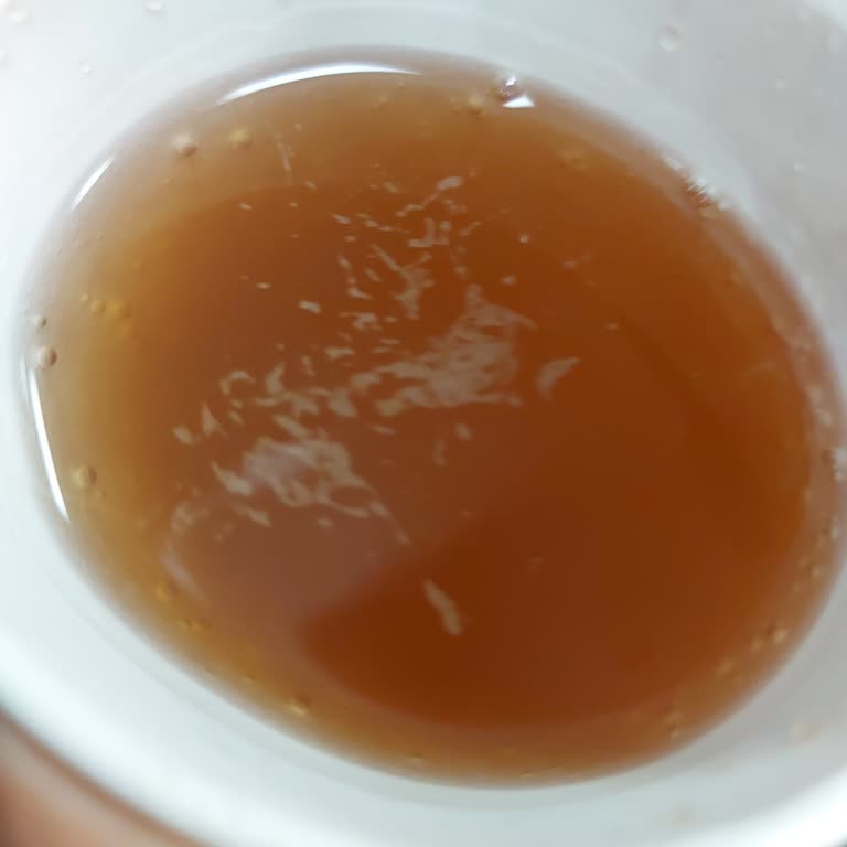 Acil Servisteki Otomat Makineleri Para Alıp Ürün Vermiyor Mağduriyet Artıyor