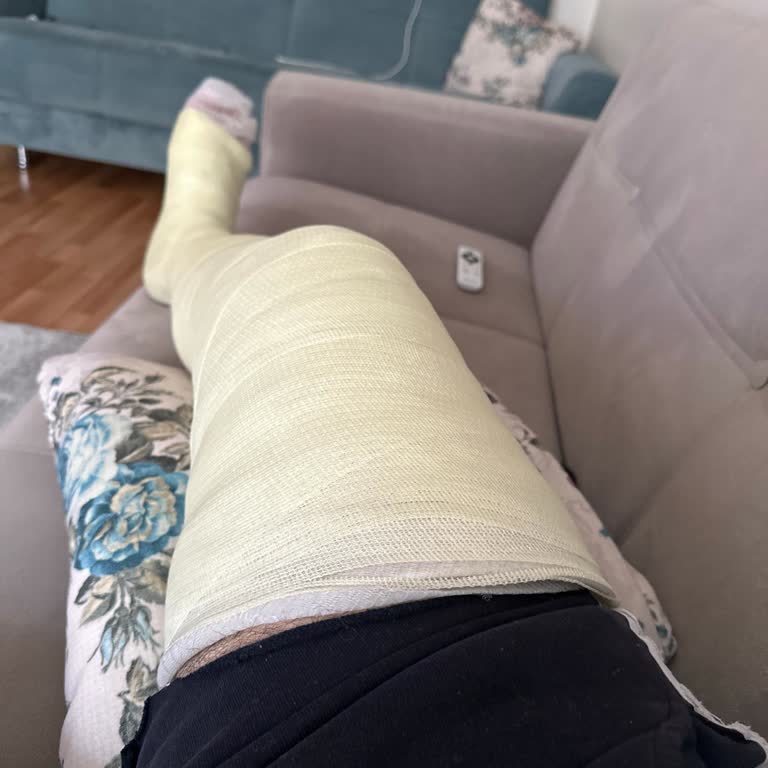 Kırık Bacakla Taşınamayan Ürün İçin İade Mağduriyeti