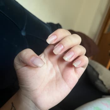 Aldığım Mantının İçinden Tırnak Çıktı Yaşadığım Hijyen Şoku