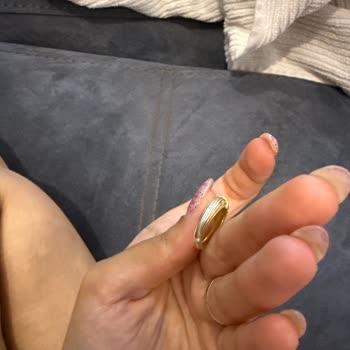 Aldığım Yüzüklerin Kaplaması Bir Ay Dolmadan Soldu Müşteri Hizmetlerinden Dönüş Alamadım