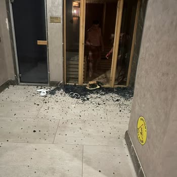 SPA Bölümünde İlgisizlik Ve Güvenlik Sorunu Mağduriyeti