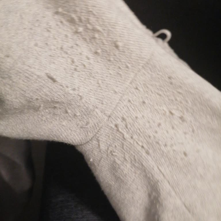 Zara Eşofman Takımında Kısa Sürede Tüylenme Ve Müşteri Hizmetlerine Ulaşamama Sorunu