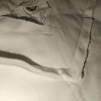 Dolap Platformunda İstenmeyen Ve Kusurlu Ürün İadesi Sorunu