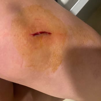 Mağazada Güvenlik Eksikliği Ve Personel İlgisizliği Nedeniyle Yaşanan Sağlık Sorunu