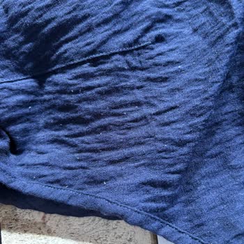 Elbise İki Kullanımda Yıprandı, Mağaza Sorumluluğu Kabul Etmiyor