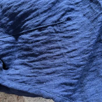 Elbise İki Kullanımda Yıprandı, Mağaza Sorumluluğu Kabul Etmiyor